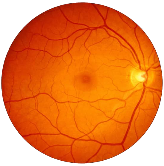 Retina