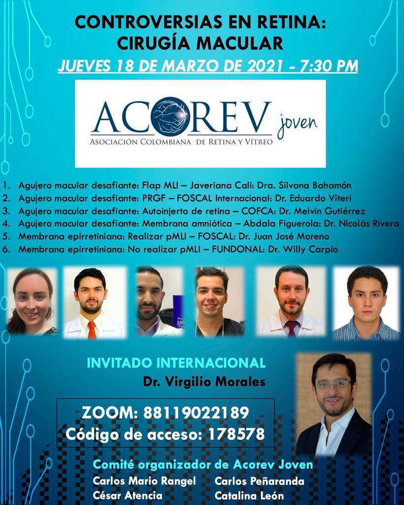 Controversias en retina, cirugía macular